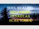 Therapautic Massage Visiting Service Gold Coast
